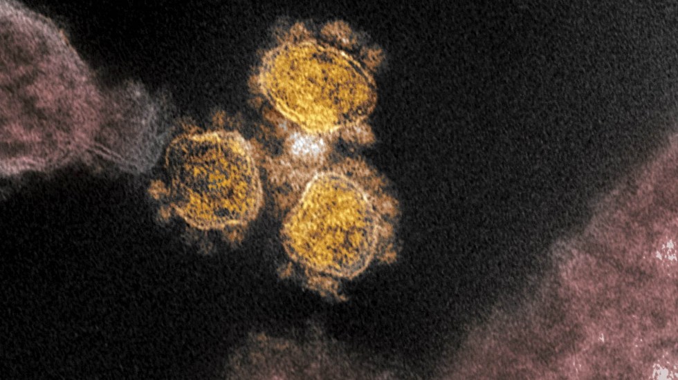 //aebios.org/wp-content/uploads/2020/03/coronavirus-covid-19-microscopio-virus-2.jpg